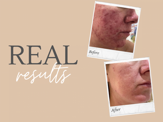 Look... skin transformations to WOW!