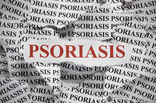 What is psoriasis and how can you treat it?