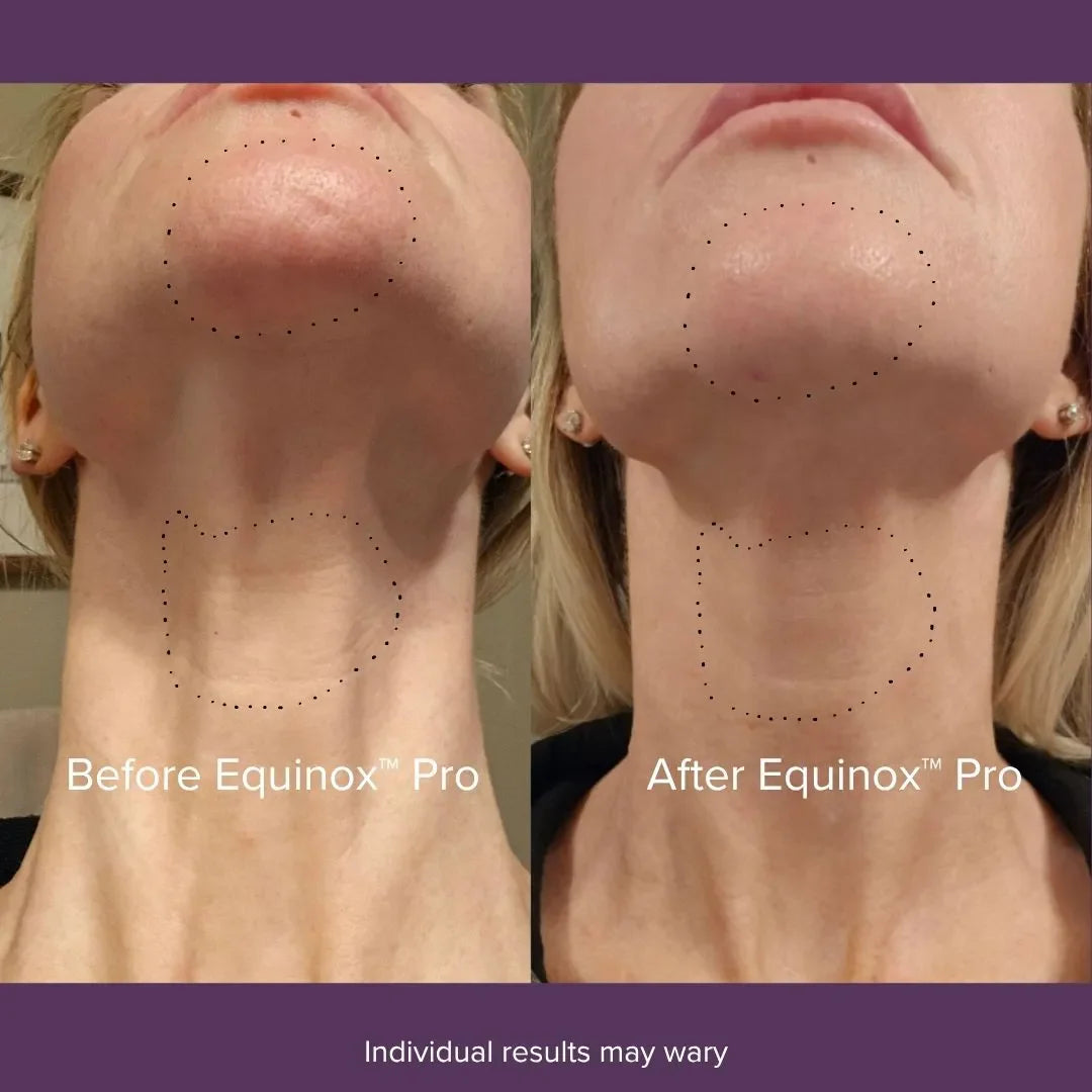 Equinox™ Pro LED Mask