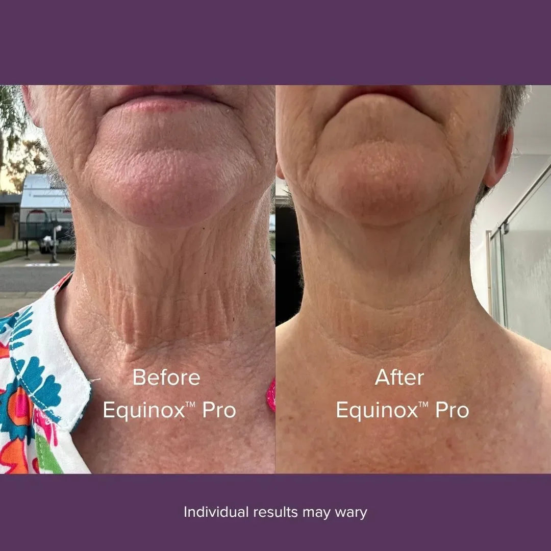 Equinox™ Pro LED Mask